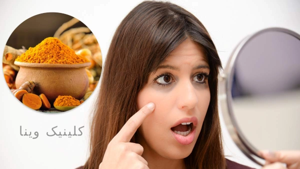 رفع سیاهی دور چشم
