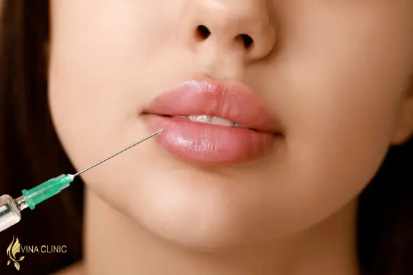 تزریق آنزیم برای از بین بردن ژل لب