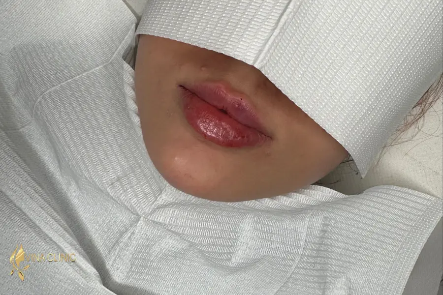 ژل لب قلوه ای