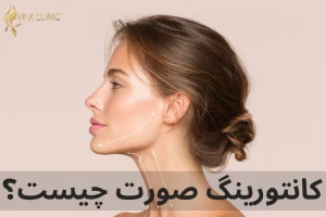 کانتورینگ صورت چیست؟